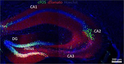 Cognitive synaptopathy: synaptic and dendritic spine dysfunction in age-related cognitive disorders